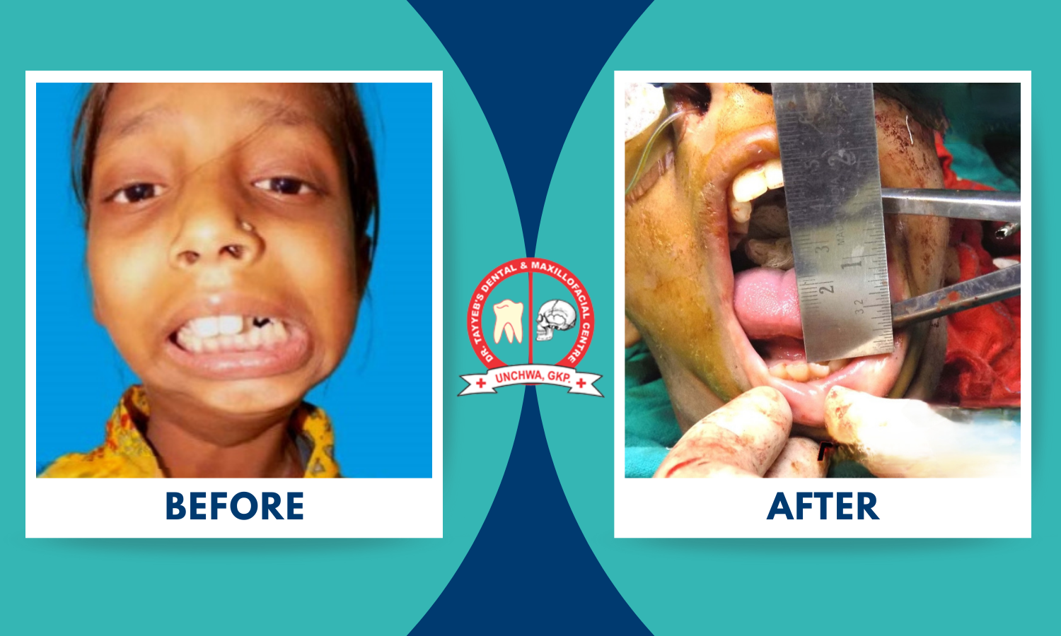 tmj processor at dr tayyeb's